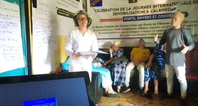 Journée de sensibilisation à l’albinisme : un albinos doit être respecté comme toute autre personne (Dr SOPHONIE Kyakimwa)